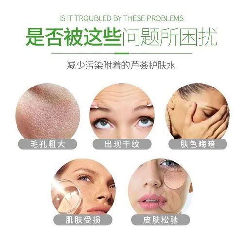 大瓶芦荟精华爽肤水补水美白收缩毛孔晒后修复玻尿酸保湿水喷雾女